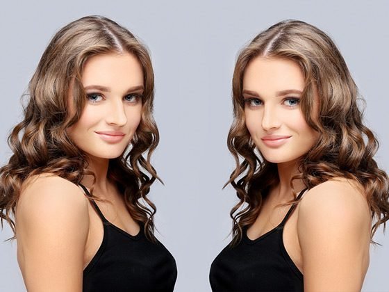 Lifting facial: resultado de rejuvenecimiento del rostro y cuello con cirugía de estiramiento (imagen ilustrativa)