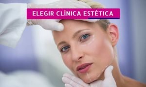 7 consejos para elegir clínica estética