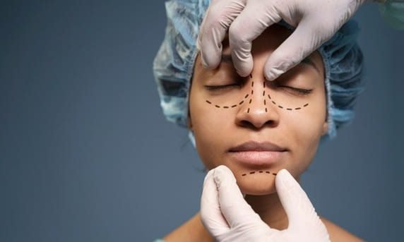 ¿Qué hace la rinoplastia con un tabique desviado?