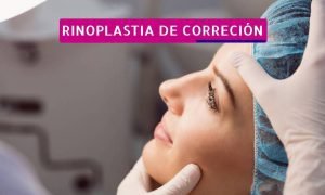 Rinoplastia para corregir el tabique nasal