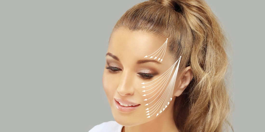 Mujer con rostro rejuvenecido tras lifting facial — líneas de tracción facial ilustradas